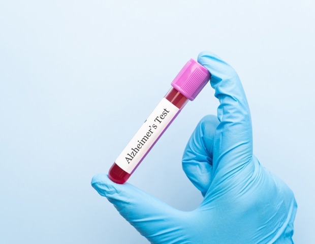 Identifying the ages when Alzheimer’s biomarkers sharply change