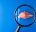 Liver fat may disrupt post-meal glucagon control in early type 2 diabetes