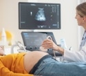 Physician mothers return to work sooner than many Canadian parents, study finds