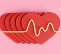 Two leading heart risk tools pass a major global test