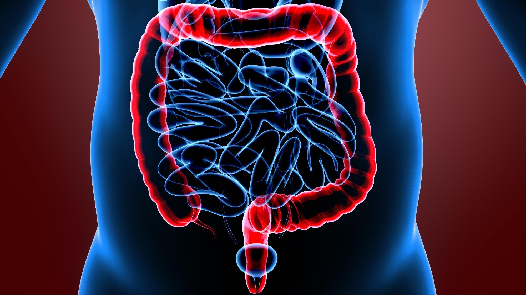 Using AI to improve success rates of fecal microbiota transplants