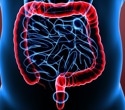 Using AI to improve success rates of fecal microbiota transplants