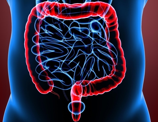Using AI to improve success rates of fecal microbiota transplants