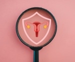 Why experts say PCOS needs a new name