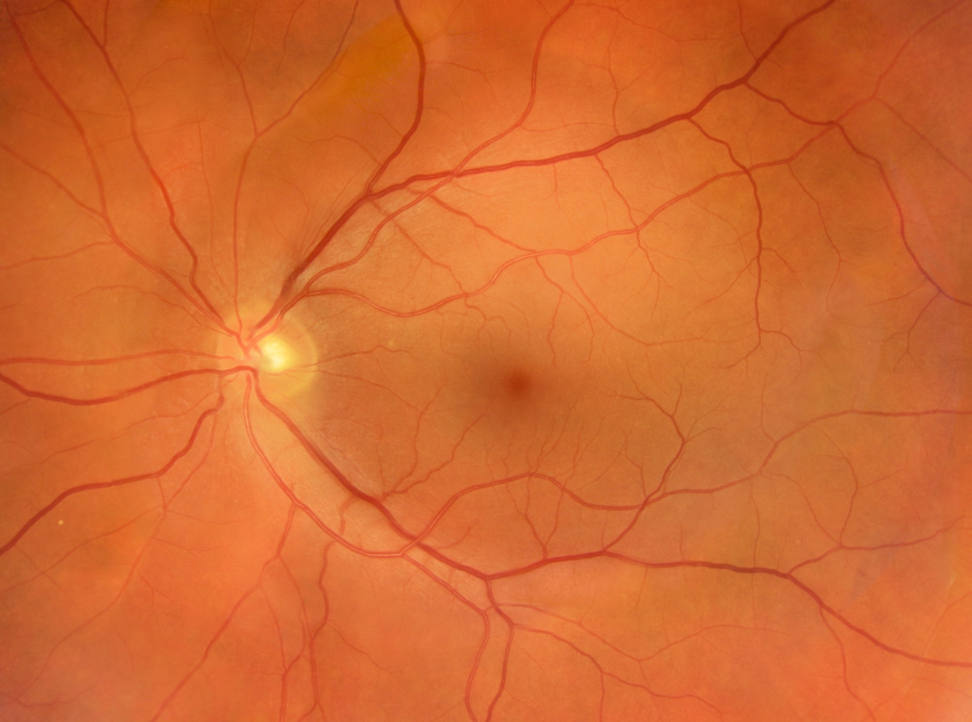 Study: Retinal biological age correlates with bone mineral density and fracture risk score and predicts incident osteoporosis. Image Credit: Steve Bottoms / Shutterstock