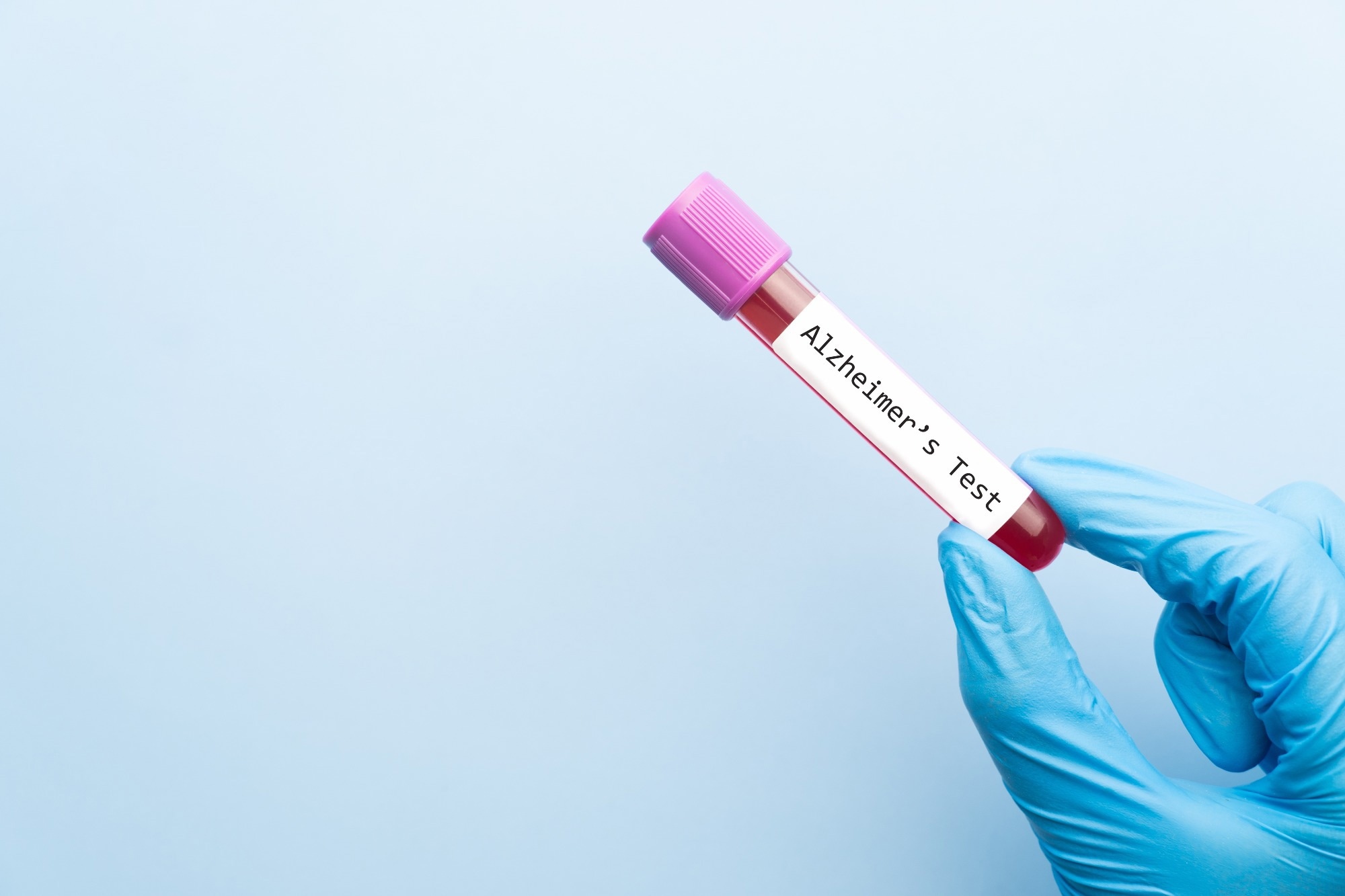 Blood metabolite patterns could reveal dementia risk in midlife
