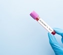 Blood metabolite patterns could reveal dementia risk in midlife