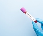 Blood metabolite patterns could reveal dementia risk in midlife