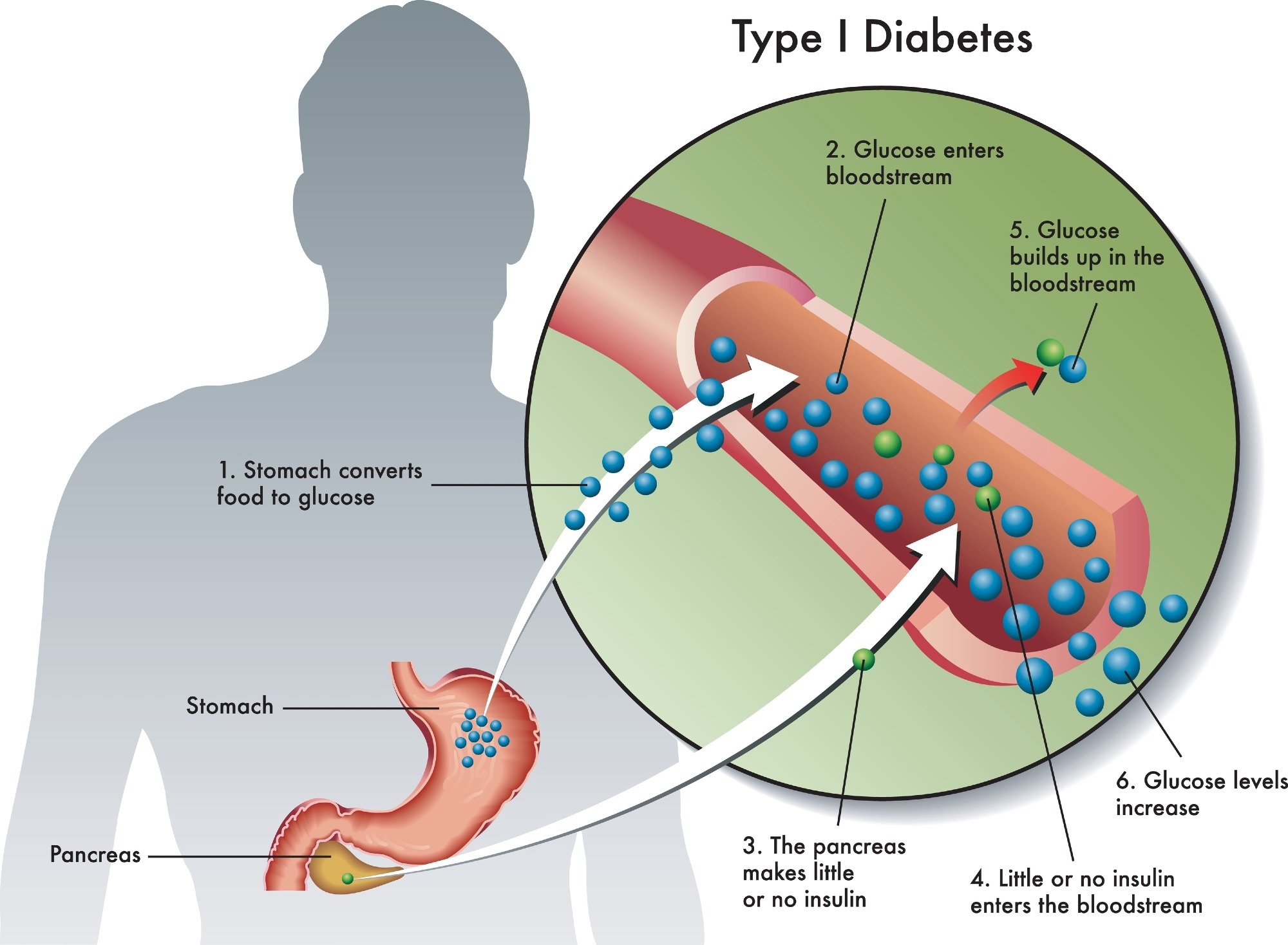 Review: New and emerging therapies in type 1 diabetes mellitus. Image Credit: rob9000 / Shutterstock