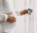 Pregnancy magnifies heart risk, but age alone does not explain why