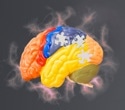 Poor sleep may flag early Alzheimer’s risk in genetically vulnerable older women