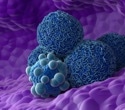 Scientists reveal why common pancreatic precancer lesions rarely turn deadly
