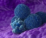 Scientists reveal why common pancreatic precancer lesions rarely turn deadly