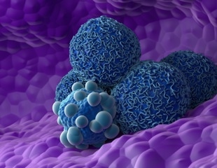 Scientists reveal why common pancreatic precancer lesions rarely turn deadly