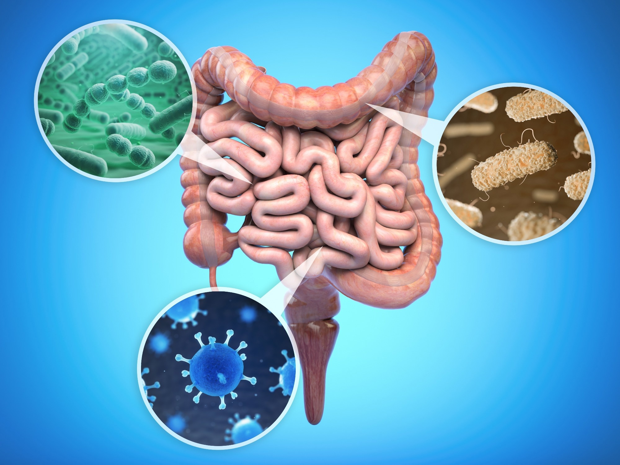 Review: Research advances in the identification of gut keystone bacteria and formulation of suitable dietary intervention strategies for restoring gut homeostasis. Image Credit: Maxx-Studio / Shutterstock