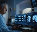 AI maps how brain fluids move to clear waste