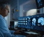 AI maps how brain fluids move to clear waste