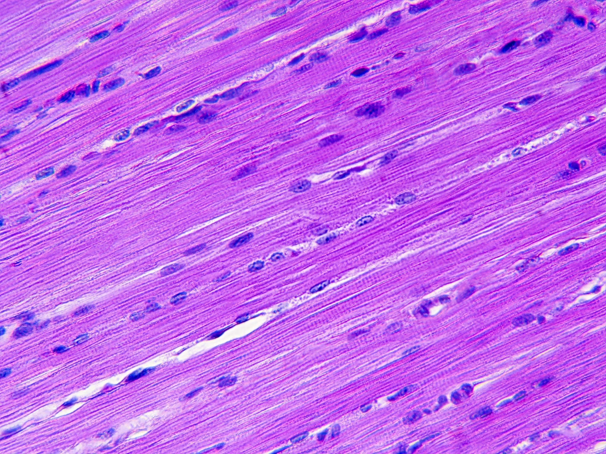 Histology image of skeletal muscle tissue