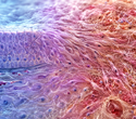 Mesenchymal drift may explain how aging cells lose their identity