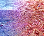 Mesenchymal drift may explain how aging cells lose their identity
