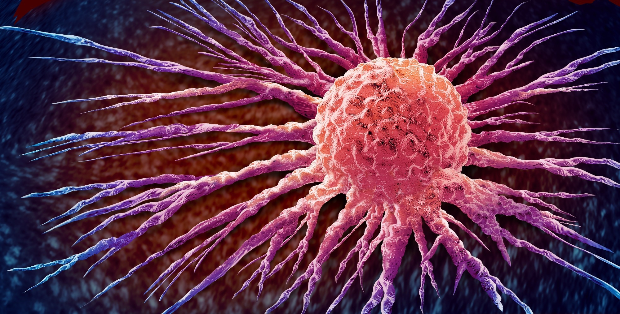 Brief Report: Impact of Population-Based Pathogenic Variant Testing on Risk-Based Breast Screening Recommendations. Image Credit: Lightspring / Shutterstock