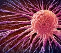 Genetic testing finds breast cancer risks that standard screening models miss