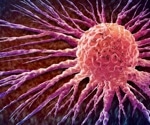 Genetic testing finds breast cancer risks that standard screening models miss