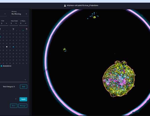 Scaling organoid workflows with automation and AI for drug discovery
