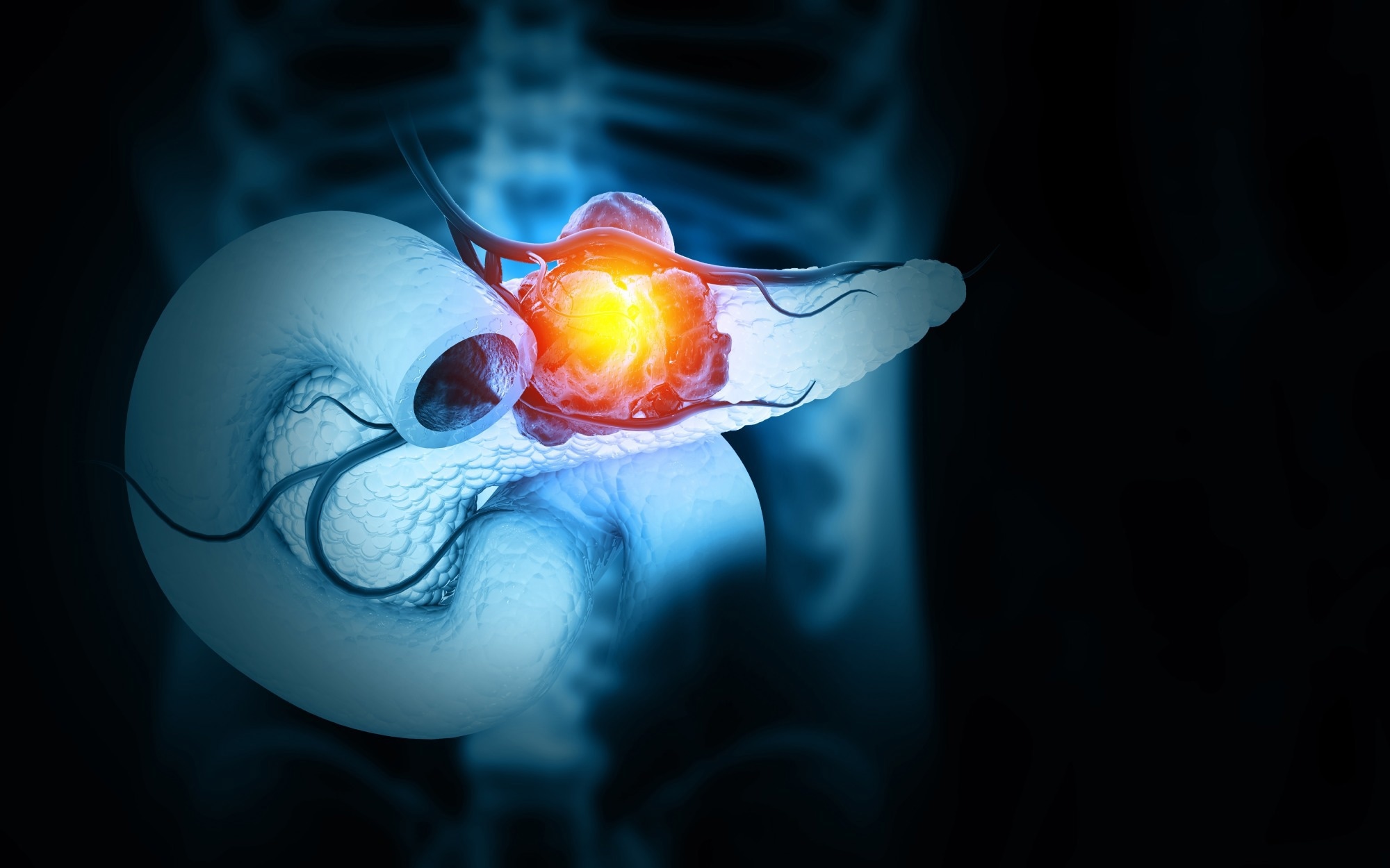 Study: A targeted combination therapy achieves effective pancreatic cancer regression and prevents tumor resistance. Image Credit: crystal light / Shutterstock