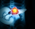 Three-drug strategy forces pancreatic tumors into lasting regression