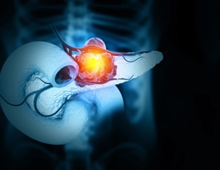 Three-drug strategy forces pancreatic tumors into lasting regression