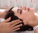 Acupuncture improves stroke recovery and reshapes brain networks