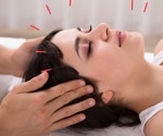 Acupuncture improves stroke recovery and reshapes brain networks