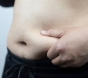 Obesity drug mazdutide reduces weight and waist size in major trial
