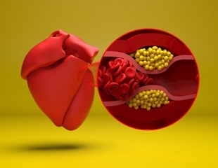 GLP-1 medicines may cut clot-related risks in chronically inflamed patients