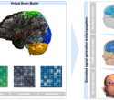 Digital brain twin recreates brain activity in a toddler with autism