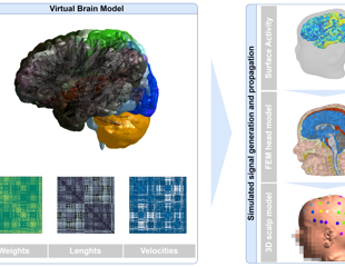 Digital brain twin recreates brain activity in a toddler with autism