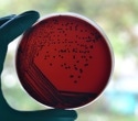Australia’s diphtheria outbreak shows why boosters, antibiotics, and better housing all matter