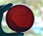 Australia’s diphtheria outbreak shows why boosters, antibiotics, and better housing all matter