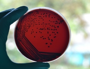 Australia’s diphtheria outbreak shows why boosters, antibiotics, and better housing all matter