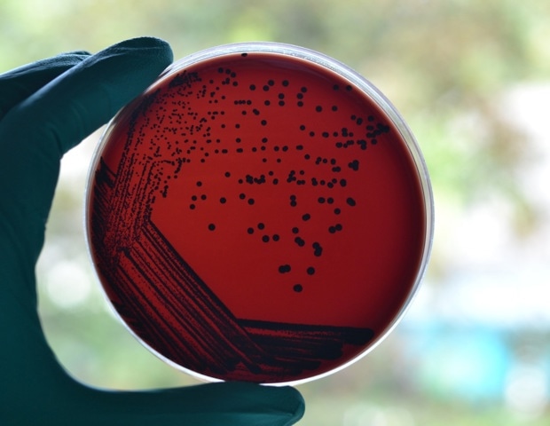 Australia’s diphtheria outbreak shows why boosters, antibiotics, and better housing all matter