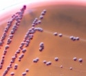 Gut bacteria may help explain why fatigue appears before illness