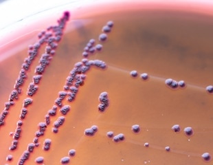 Gut bacteria may help explain why fatigue appears before illness