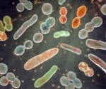 Gut microbes may help explain why obesity and type 2 diabetes become harder to reverse