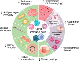 Aging immune cells may explain why autoimmunity rises later in life
