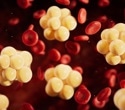 Elite athletes with higher vitamin D show healthier lipid profiles