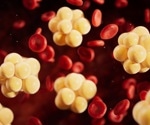 Elite athletes with higher vitamin D show healthier lipid profiles