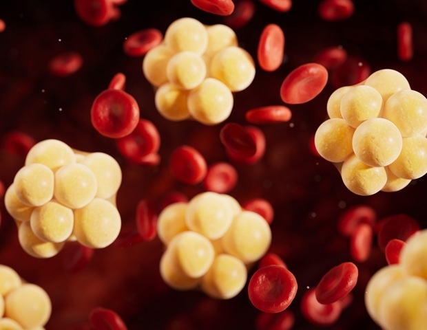 Elite athletes with higher vitamin D show healthier lipid profiles