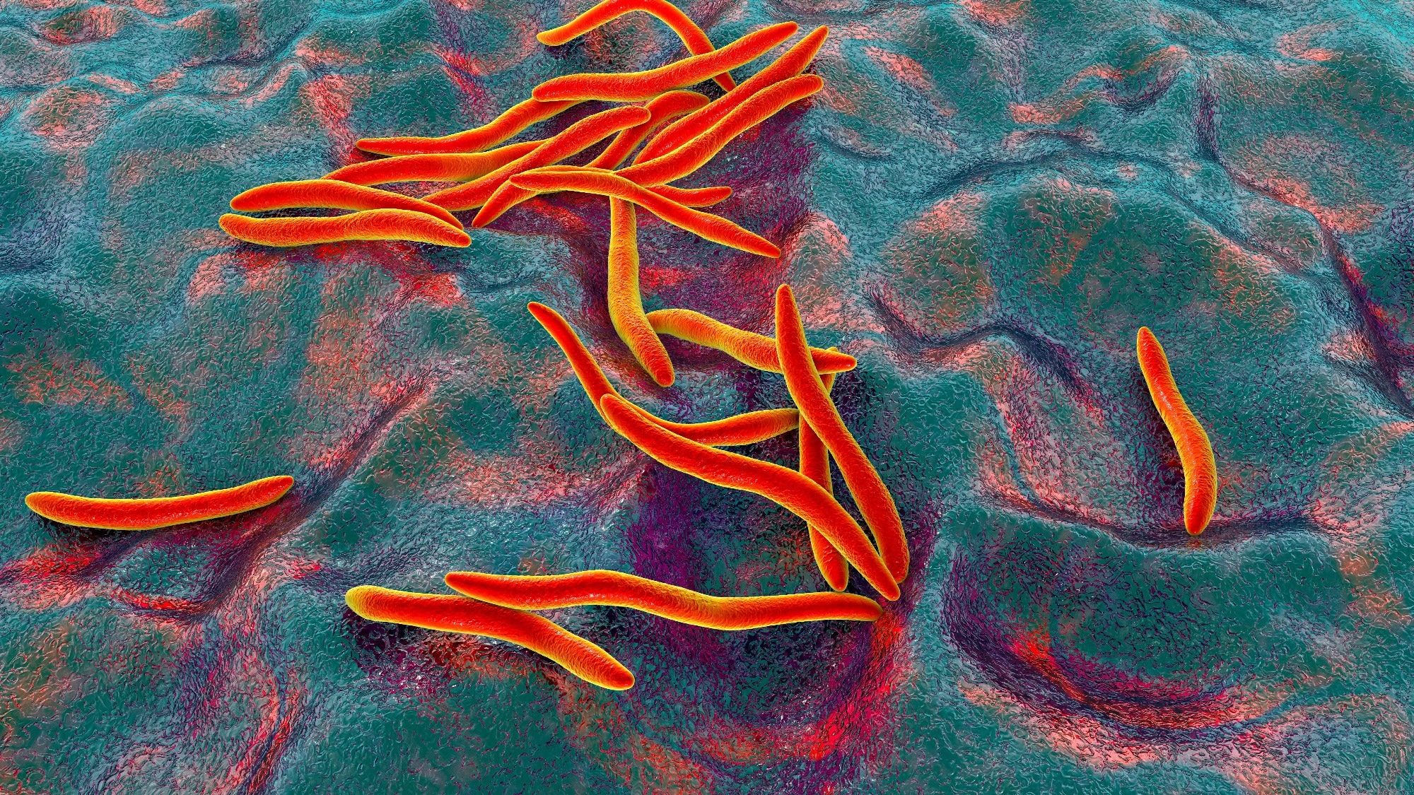 Scientists find a universal gut microbiome pattern linked to colorectal cancer