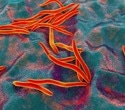Scientists find a universal gut microbiome pattern linked to colorectal cancer